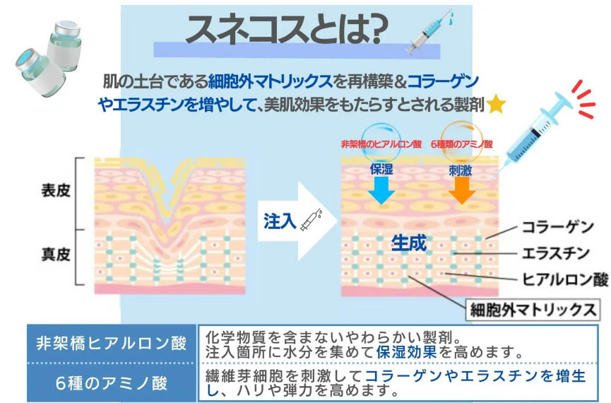 スネコスとは？