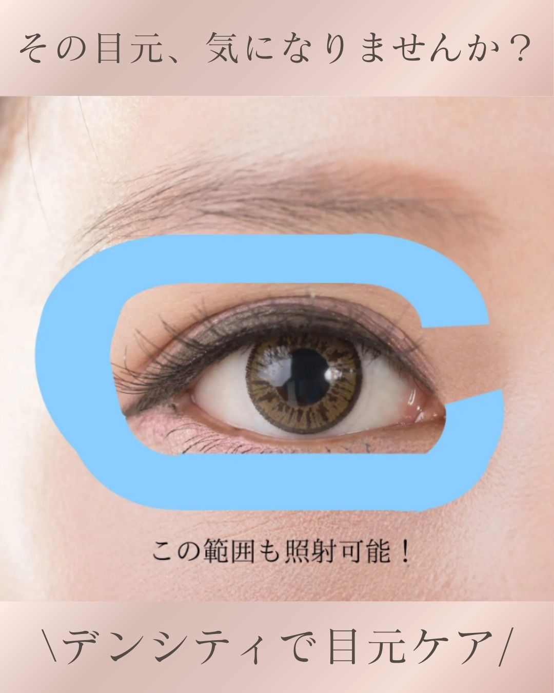 【ドクターブログ】目元の切らないリフトアップ