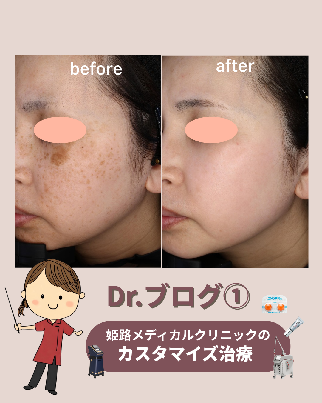 Drブログ第1回【同じ「シミ」でも治療は人それぞれ。カスタマイズ治療って？】
